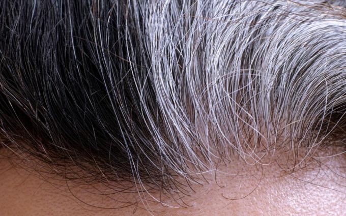 Волосы седеют от стресса и восстанавливают свой цвет при избавлении от него