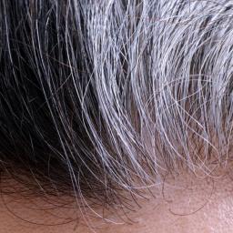 Волосы седеют от стресса и восстанавливают свой цвет при избавлении от него